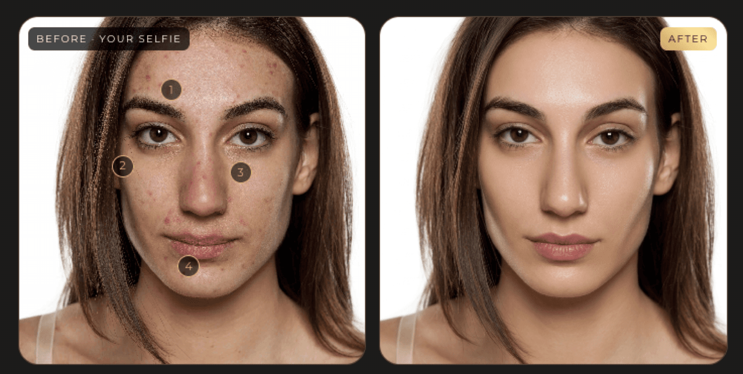 Free AI Skin Analysis — a zone-mapped selfie beside an illustrative result