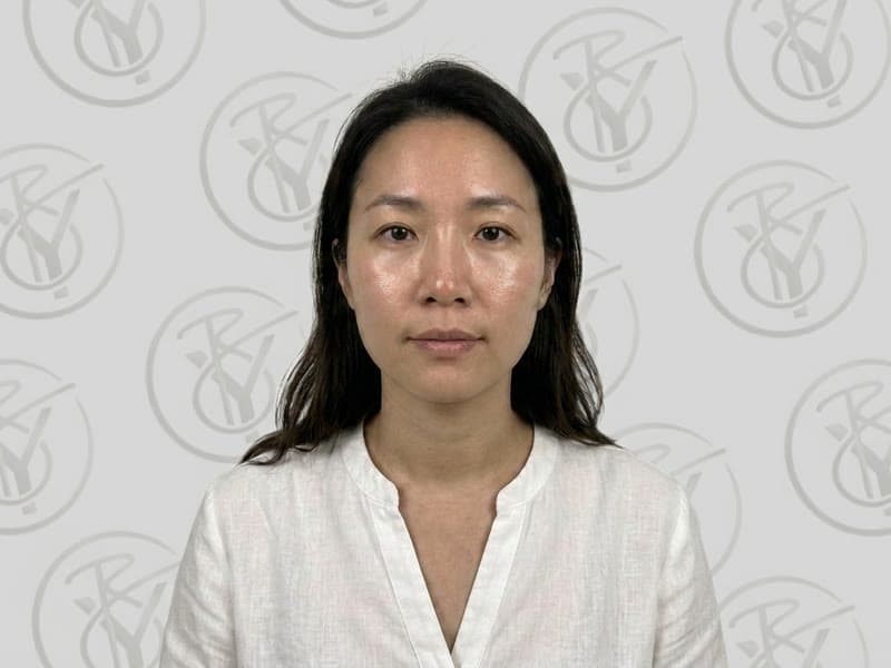 Chemical Peel — after